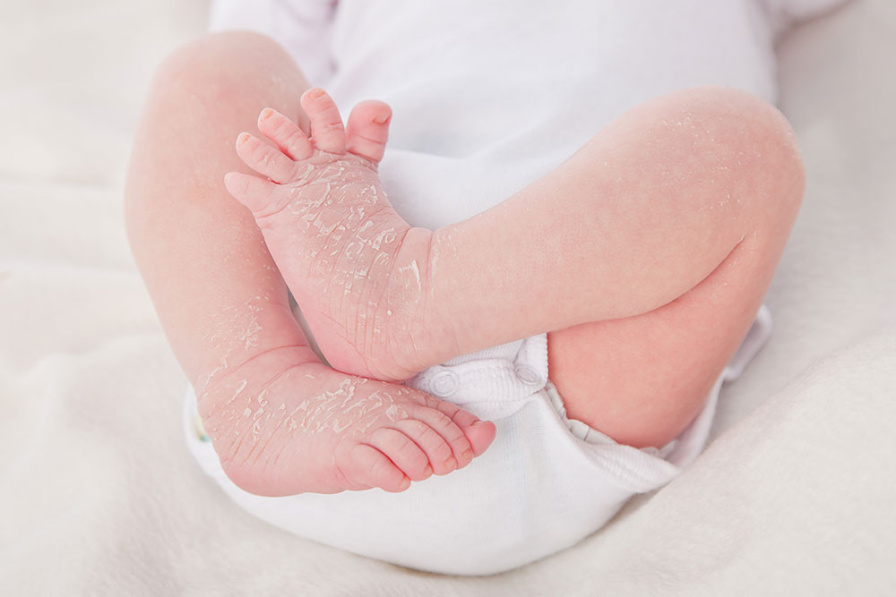 Babyfotos Kinderfotos
